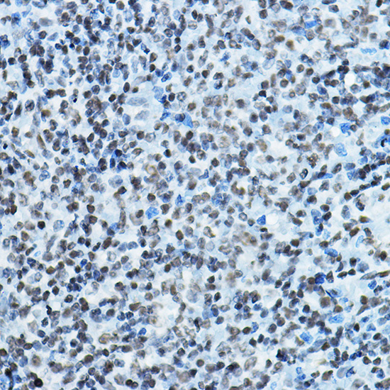 Anti-KAT7 Antibody (CAB5823)