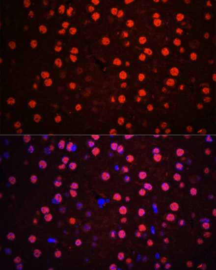 Anti-Phospho-MAPK14-T180/Y182 Antibody (CABP0526)