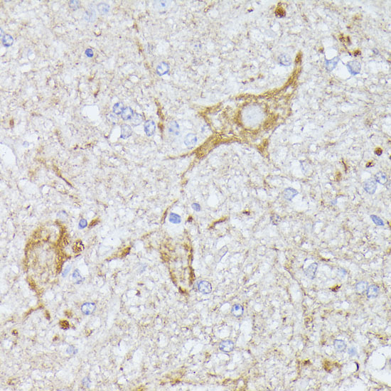 Anti-TBCA Antibody (CAB13050)