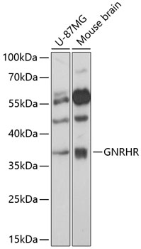 Anti-GNRHR Antibody (CAB14487)