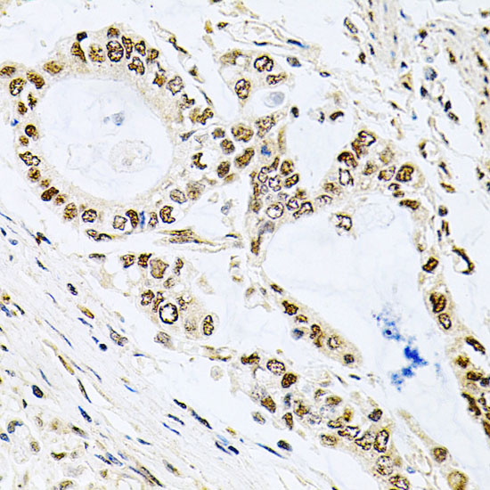 Anti-MCL1 Antibody (CAB0250)