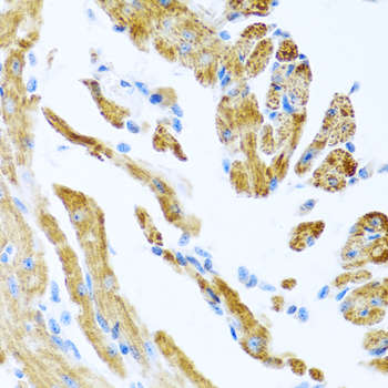 Anti-COL9A3 Polyclonal Antibody (CAB9798)