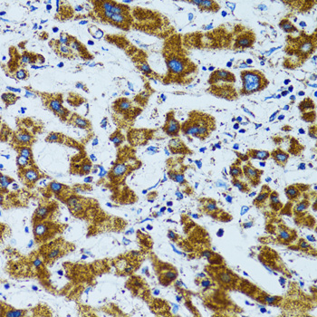 Anti-PRDX3 Antibody (CAB3076)