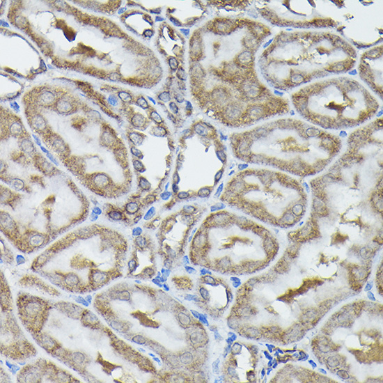 Anti-CALR Antibody [KO Validated] (CAB18013)