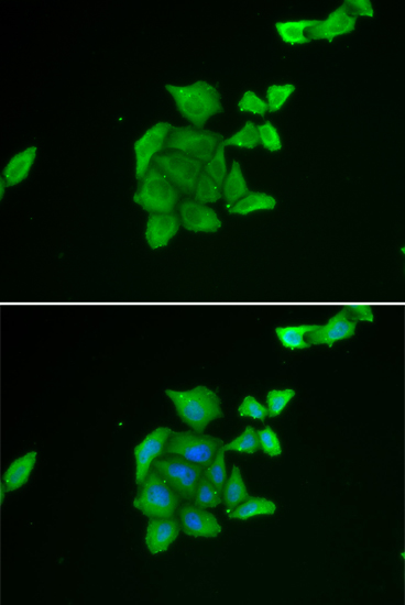 Anti-TUSC2 Antibody (CAB7075)