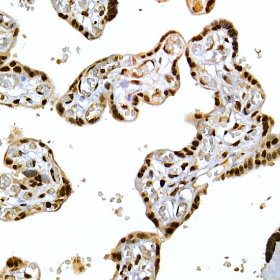 Immunohistochemistry of paraffin-embedded human placenta using SCAF4 Rabbit pAb at dilution of 1:50 (40x lens). Perform high pressure antigen retrieval with 10 mM citrate buffer pH 6. 0 before commencing with IHC staining protocol.