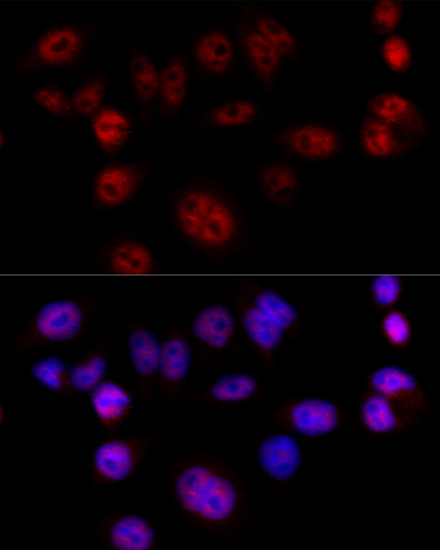 Anti-Cyclin D1 Antibody (CAB11022)