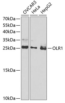 Anti-OLR1 Antibody (CAB1639)