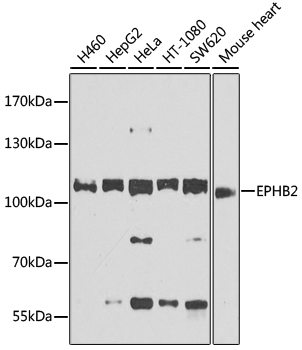 Anti-EPHB2 Polyclonal Antibody (CAB9813)