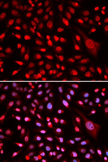 Anti-CBFB Antibody (CAB5305)