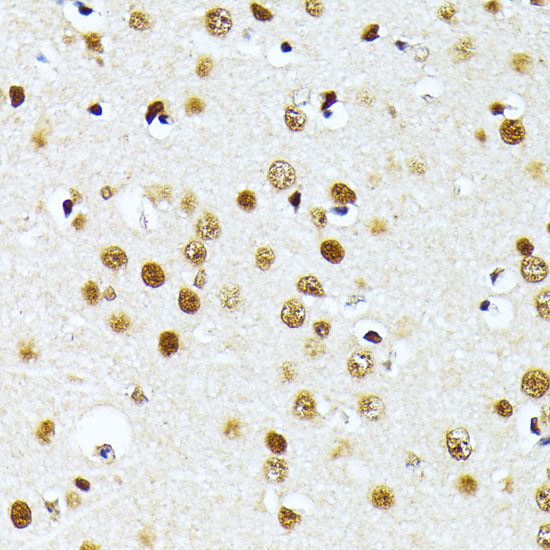 Anti-PRMT1 Antibody (CAB1055)