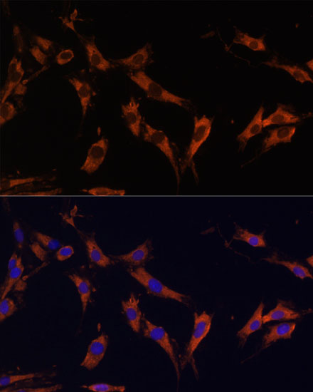 Anti-KSR1 Antibody (CAB15118)