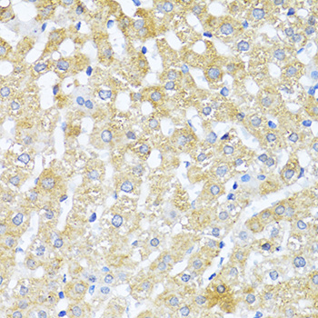 Anti-TGFB2 Antibody (CAB16226)