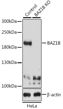 Anti-BAZ1B Polyclonal Antibody [KO Validated] (CAB9851)