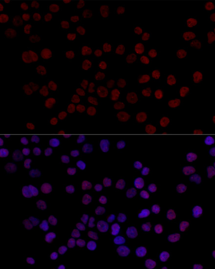 Anti-HNRNPL Polyclonal Antibody (CAB8430)