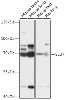 Anti-SLU7 Antibody (CAB17614)