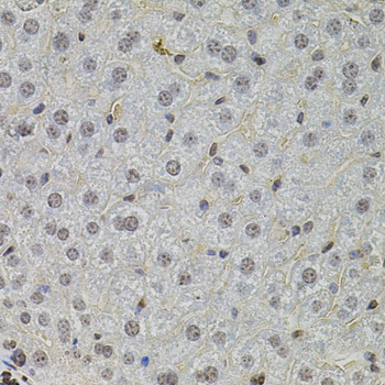 Anti-SKP2 Antibody (CAB0842)