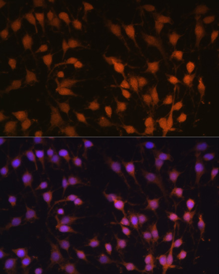 Anti-SIRT1 Antibody [KO Validated] (CAB17307)