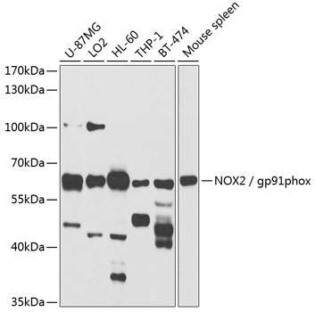 Anti-NOX2 / gp91phox Antibody (CAB1636)