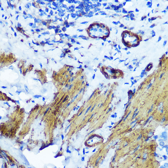 Anti-alpha smooth muscle actin Antibody (CAB7248)