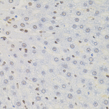 Anti-AKAP8 Antibody (CAB17302)