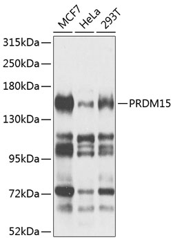 Anti-PRDM15 Polyclonal Antibody (CAB8371)