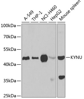 Anti-KYNU Antibody (CAB6643)