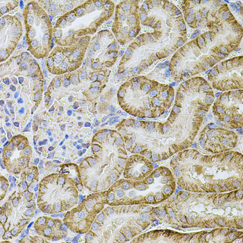 Anti-CDH16 Antibody (CAB7882)