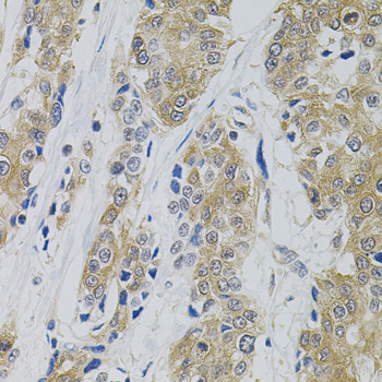 Anti-DNM2 Antibody (CAB0523)