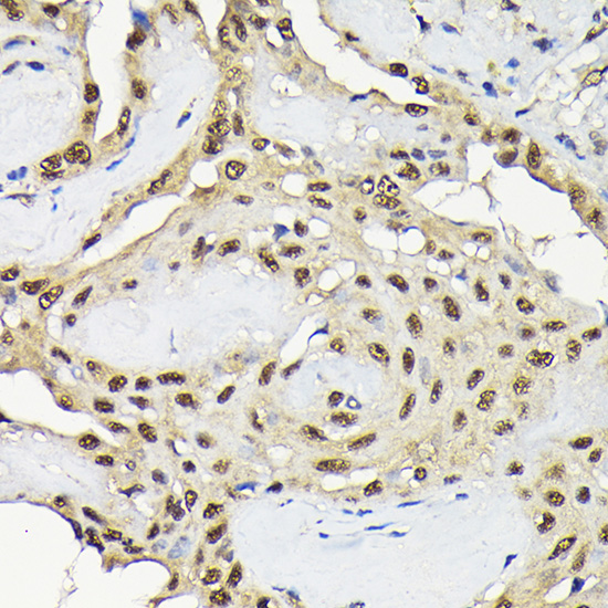 Anti-JNK1 Antibody (CAB0288)