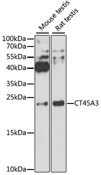 Anti-CT45A3 Antibody (CAB12887)