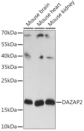 Anti-DAZAP2 Antibody (CAB14266)