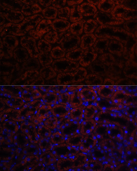 Anti-KL Antibody (CAB12028)