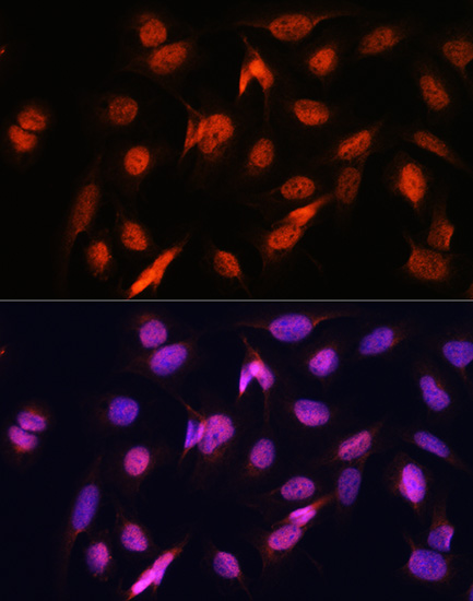 Anti-OTUB1 Antibody (CAB11656)