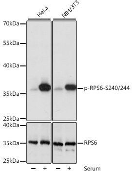 Anti-Phospho-RPS6-S240/244 Antibody (CABP0537)