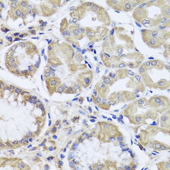 Anti-JAK2 Antibody (CAB7694)