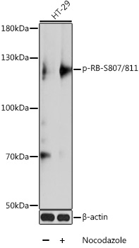 Anti-Phospho-Rb-S807/811 Antibody (CABP0484)