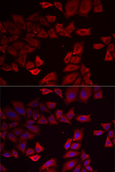 Anti-SEPHS1 Antibody (CAB13403)