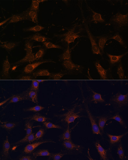 Anti-RAB21 Antibody (CAB12095)