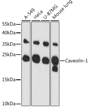 Anti-Caveolin-1 Antibody (CAB1555)