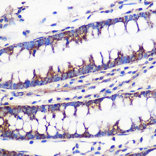 Anti-MRPL54 Antibody (CAB14957)