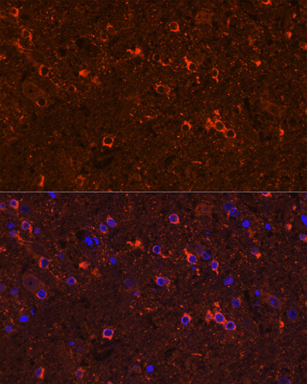 Anti-GAD2 Antibody (CAB0971)