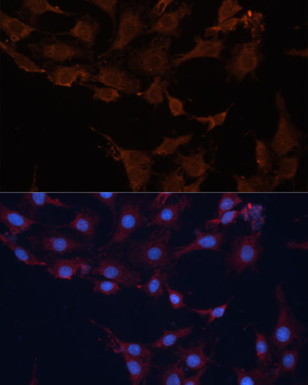 Anti-HMGCS1 Antibody (CAB3916)