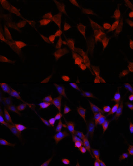 Anti-UBIAD1 Antibody (CAB14214)