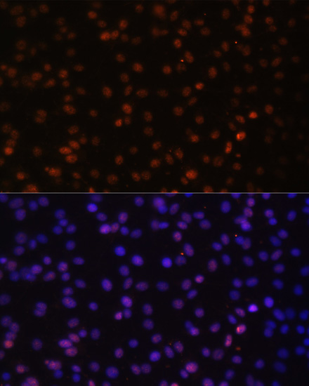 Anti-HTATSF1 Antibody (CAB14542)