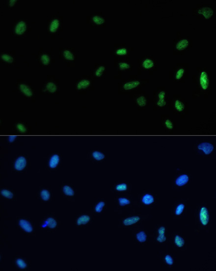 Anti-SAFB Antibody (CAB7927)