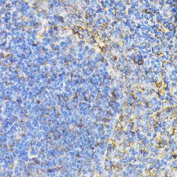 Anti-STAT4 Antibody (CAB6991)