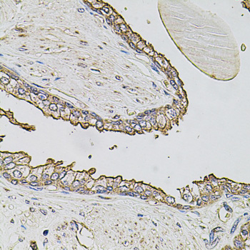 Anti-ABCC3 Polyclonal Antibody (CAB9849)