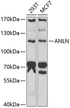 Anti-ANLN Antibody (CAB6524)