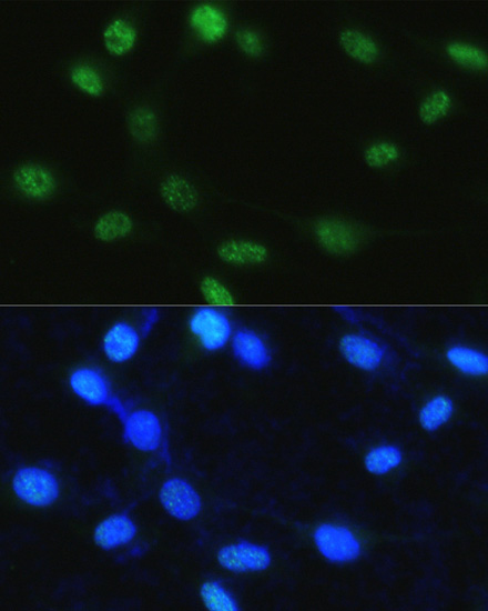 Anti-Phospho-Histone H3-S28 pAb (CABP0839)